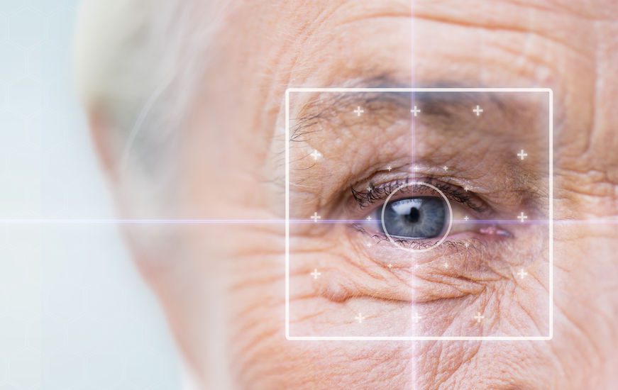 How does Cataract Affect Your Vision